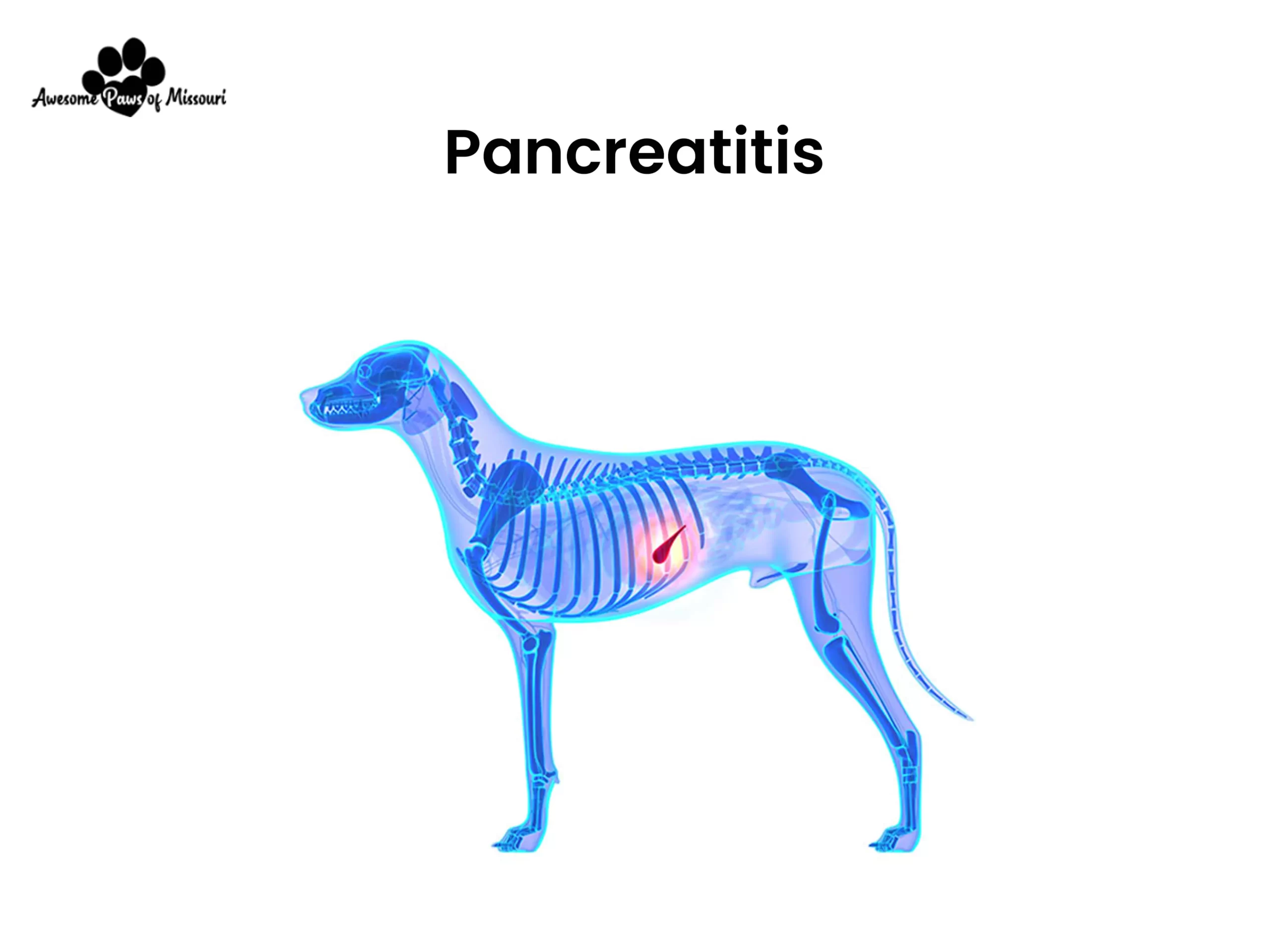 Pancreatitis - image