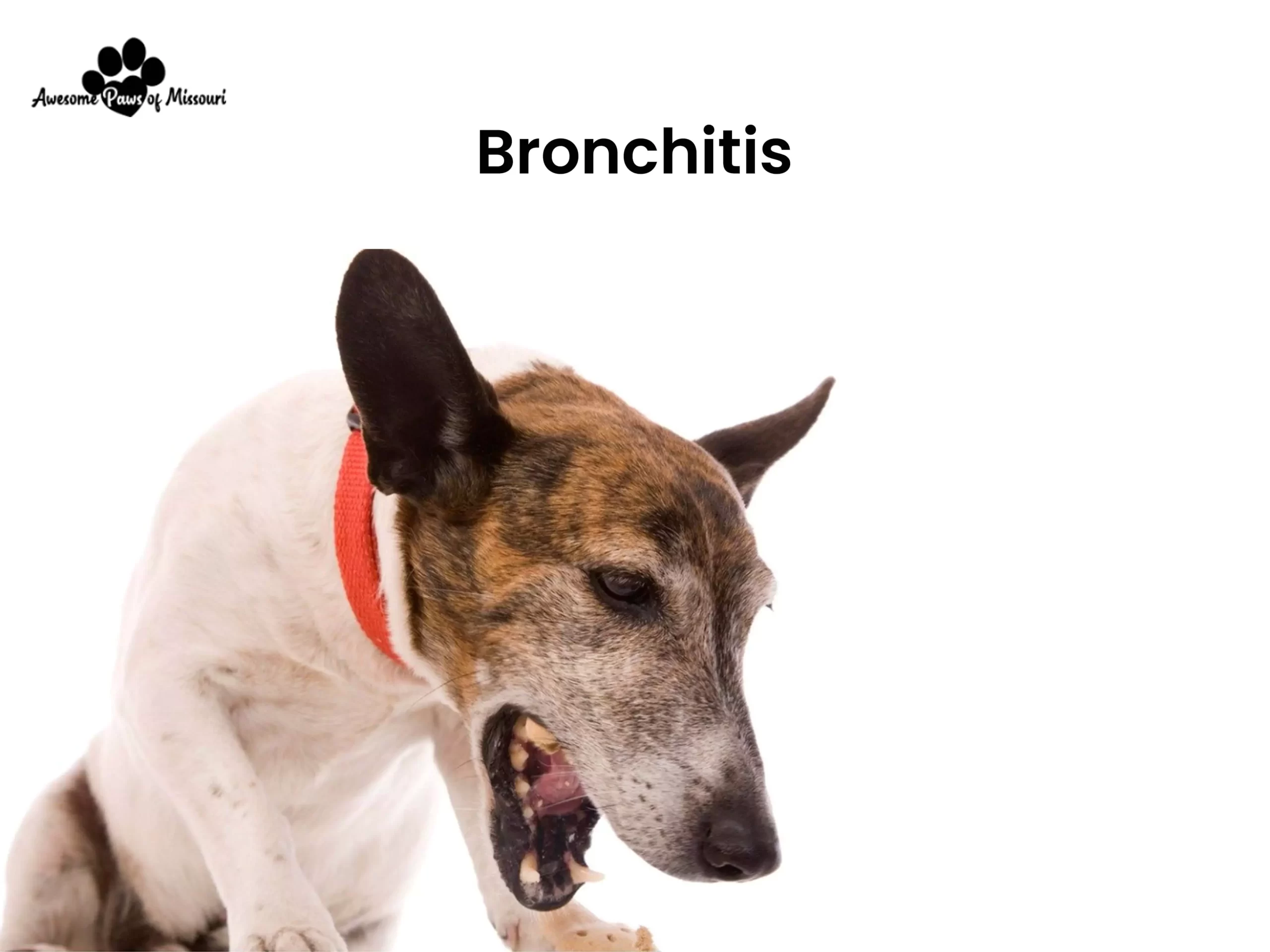 Bronchitis - image