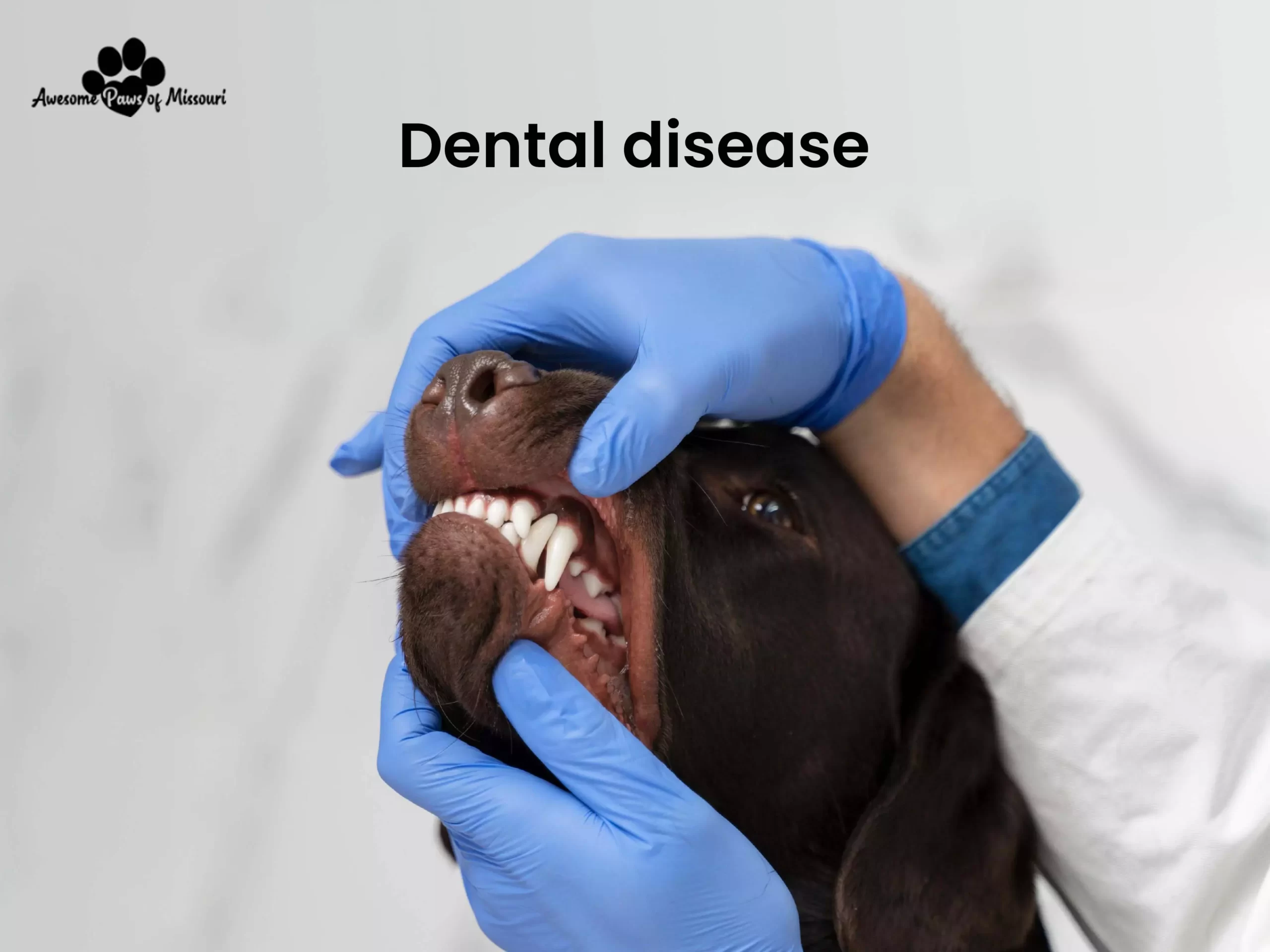 Dental disease - image