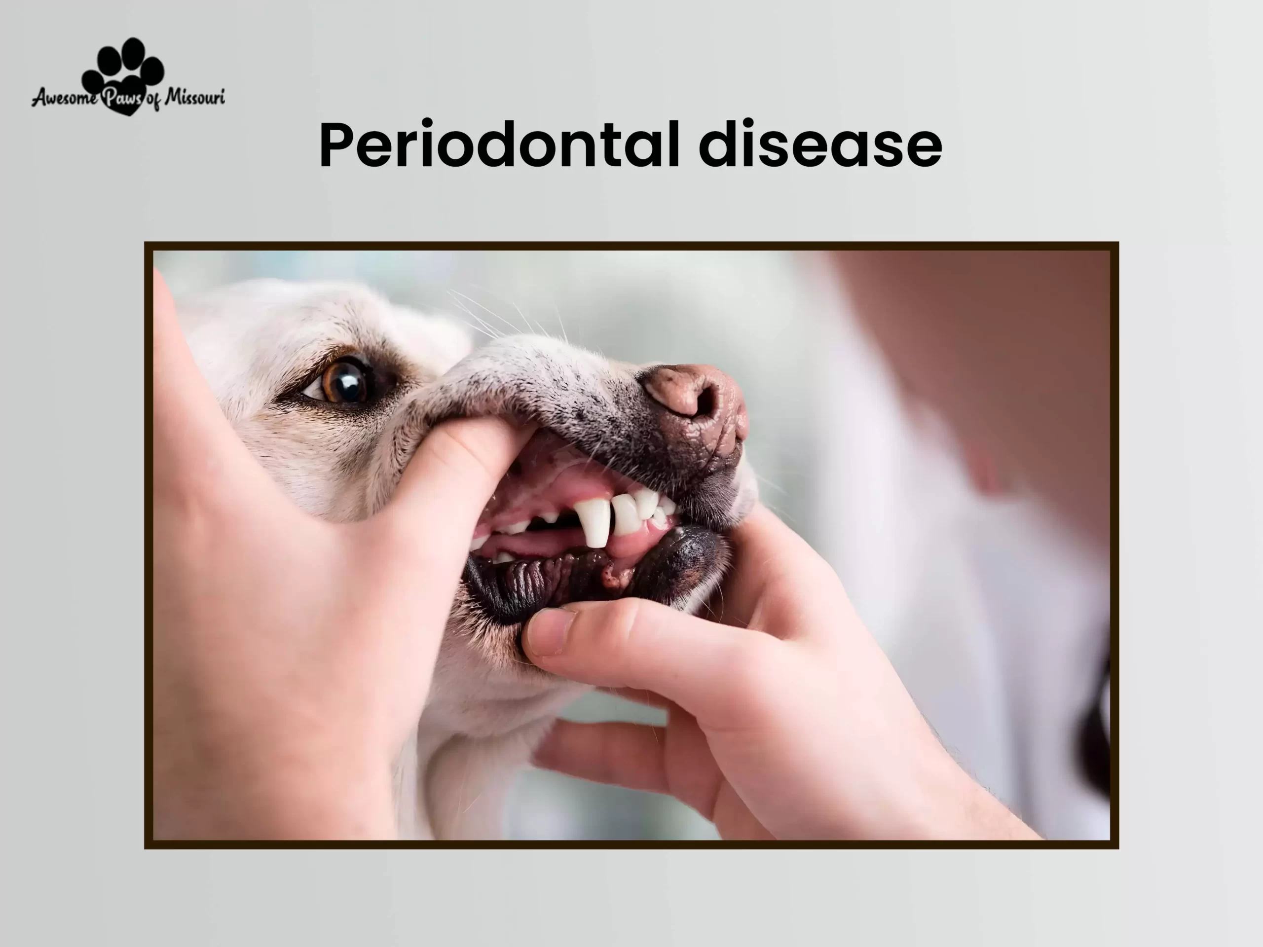 Periodontal disease - image