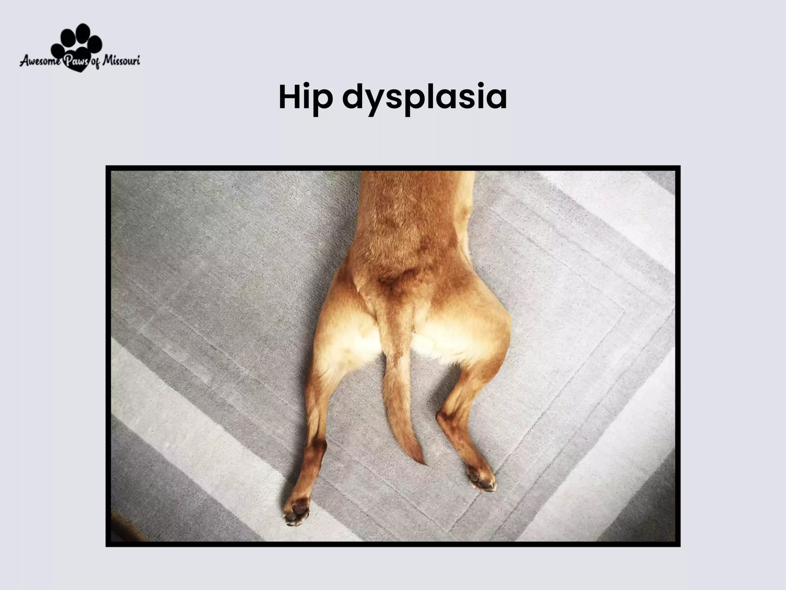 Hip dysplasia - image