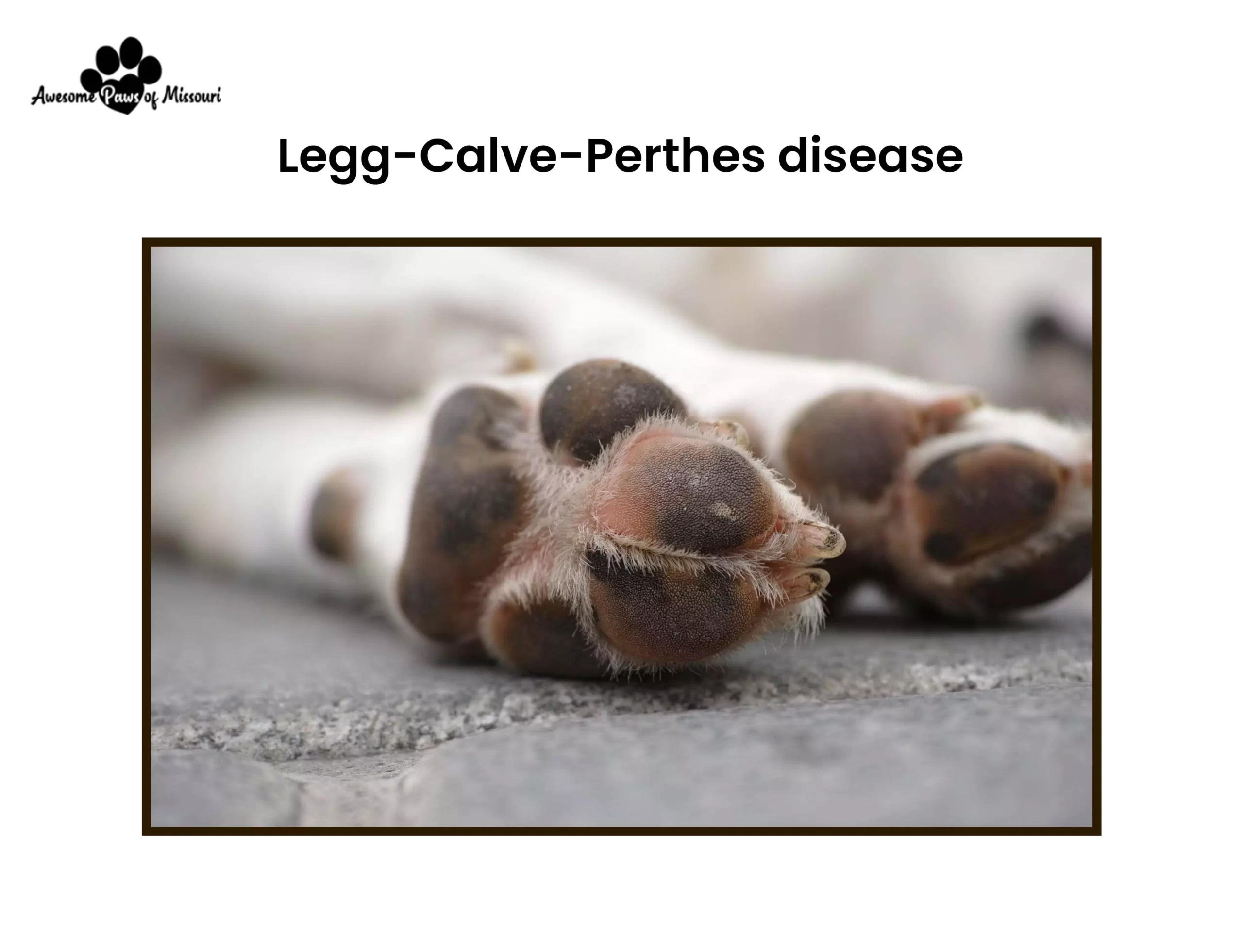 Legg-Calve-Perthes disease - image