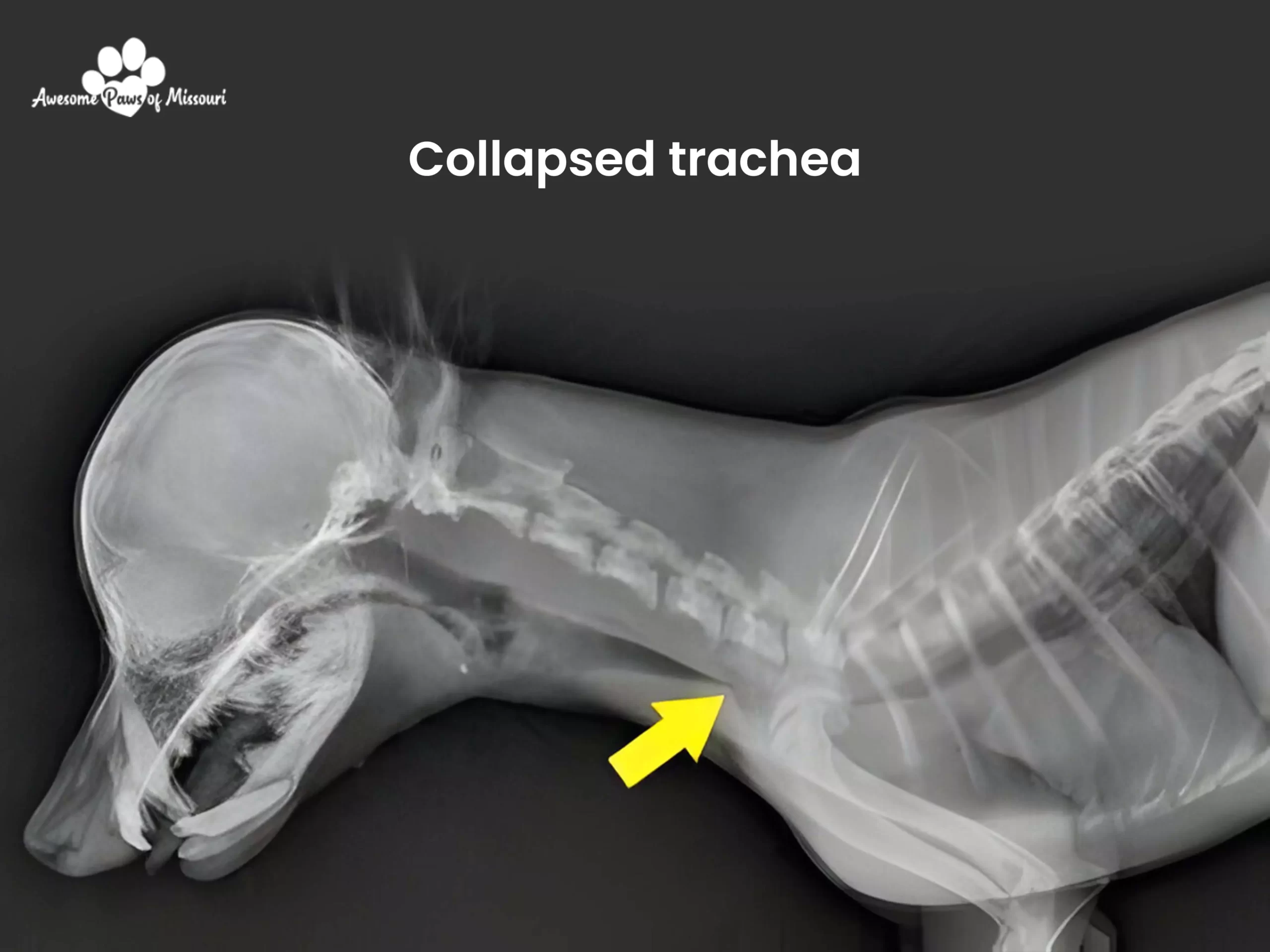 Collapsed trachea - image